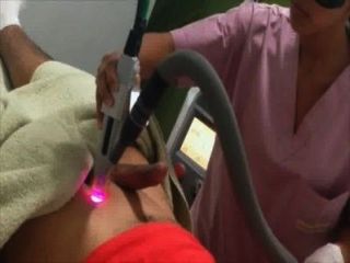 Laser