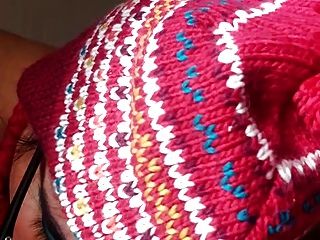 Ugly Stupid Woman With Hairy Armpits Legs And Nipples Suck